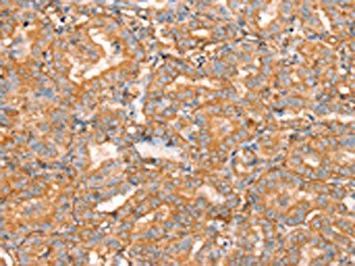 SLC16A8 Antibody