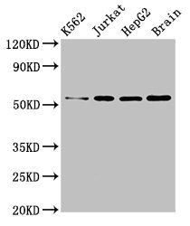 SLC16A8 antibody