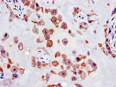 SLC18A1 Antibody