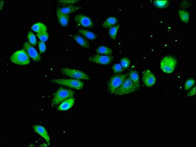 SLC18A2 Antibody