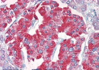 Goat anti-VMAT2 / SLC18A2 Antibody