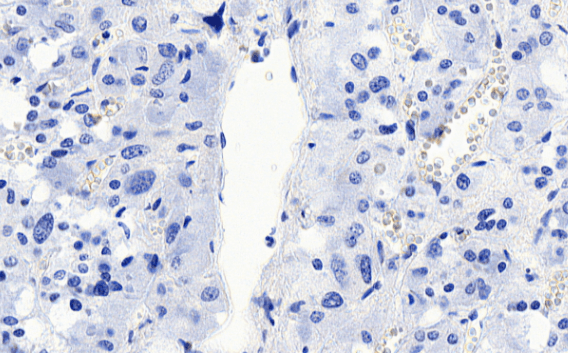 Goat anti-VMAT2 / SLC18A2 Antibody
