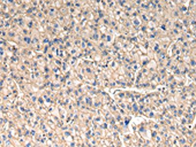 SLC1A1 antibody