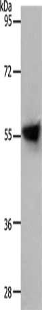 SLC1A4 Antibody