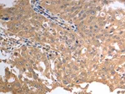 SLC1A4 Antibody