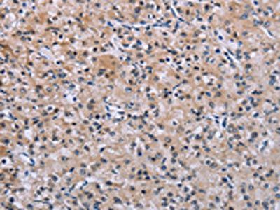 SLC1A6 antibody