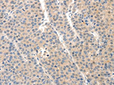 SLC20A1 antibody