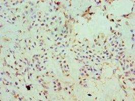 SLC20A2 Antibody