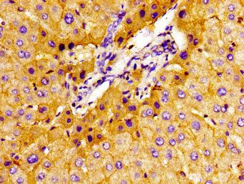 SLC22A1 Antibody