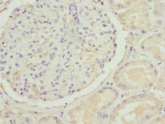 SLC22A11 Antibody