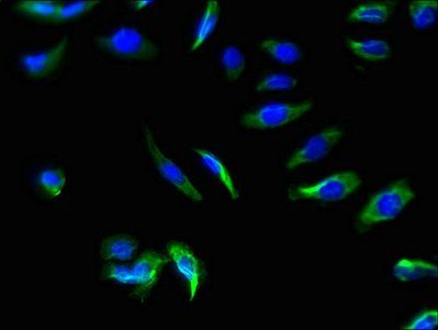 SLC22A17 Antibody