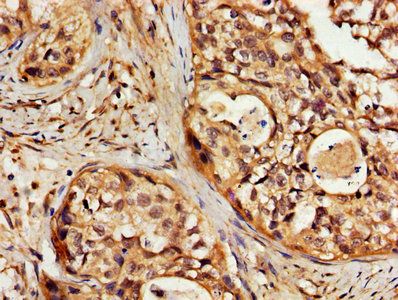 SLC22A17 Antibody