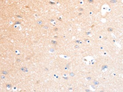 SLC22A17 Antibody