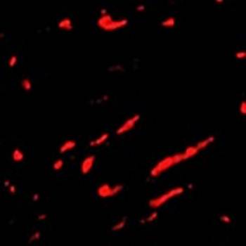 Slc22A17 Rabbit Polyclonal Antibody