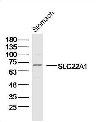 SLC22A1 antibody