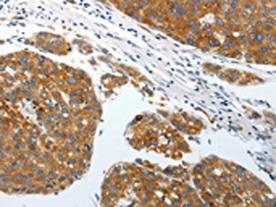 SLC22A3 Antibody