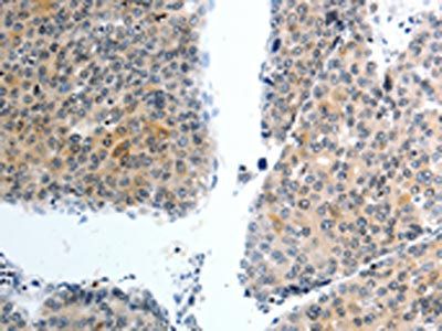 SLC22A3 antibody