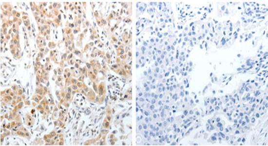 SLC22A3 Antibody