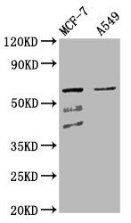 SLC22A5 Antibody