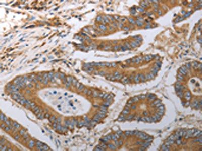 SLC22A6 Antibody