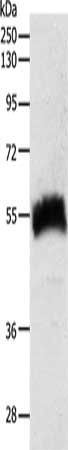 SLC22A6 antibody