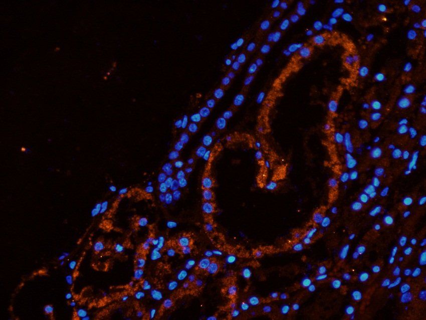 SLC22A6 antibody