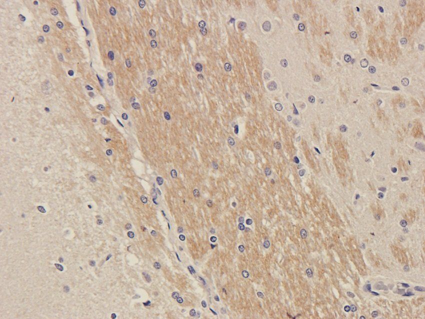 SLC22A6 antibody