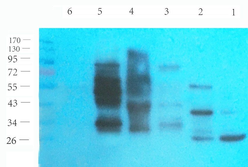 SLC22A6 antibody