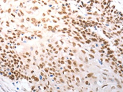 SLC22A8 Antibody
