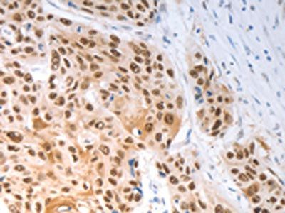 SLC22A8 Antibody