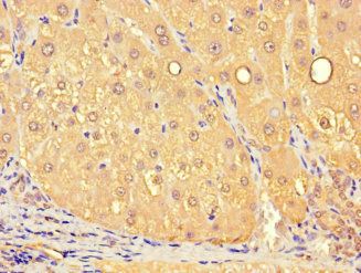 SLC25A10 antibody