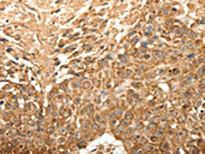 SLC25A11 antibody