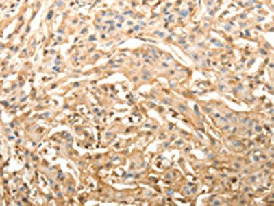 SLC25A11 antibody