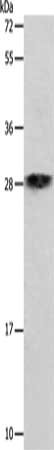 SLC25A11 Antibody