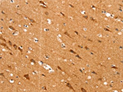 SLC25A12 Antibody