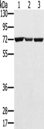 SLC25A13 antibody