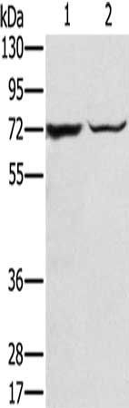 SLC25A13 antibody