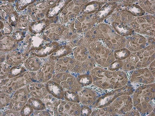SLC25A13 antibody [N3C2], Internal