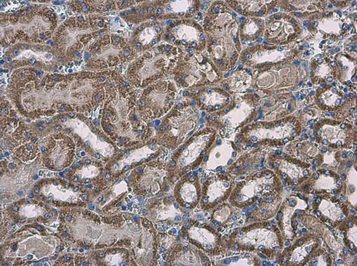 SLC25A13 antibody [N3C2], Internal