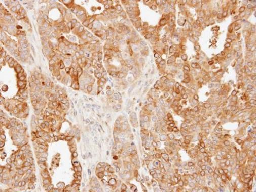 SLC25A13 antibody [N3C2], Internal