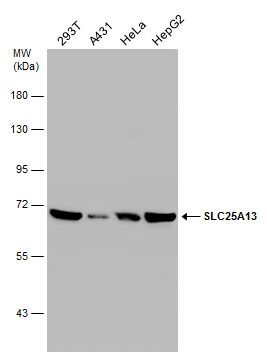 SLC25A13 antibody [N3C2], Internal