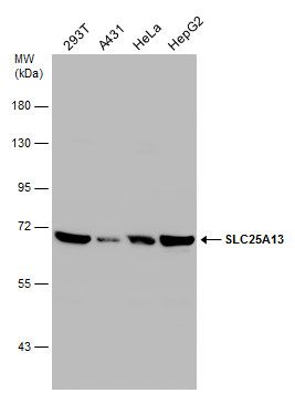 SLC25A13 antibody