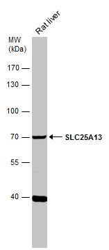SLC25A13 antibody