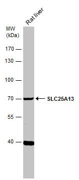 SLC25A13 antibody [N3C2], Internal