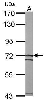 SLC25A13 antibody