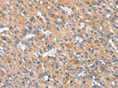 SLC25A2 Antibody