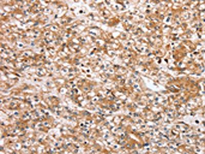 SLC25A20 Antibody