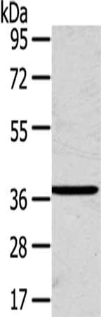 SLC25A20 Antibody