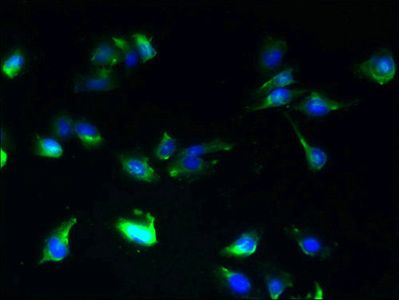 SLC25A25 antibody