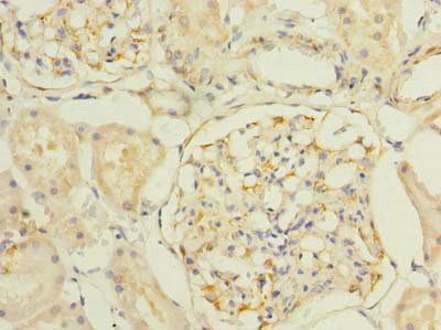 SLC25A33 Antibody